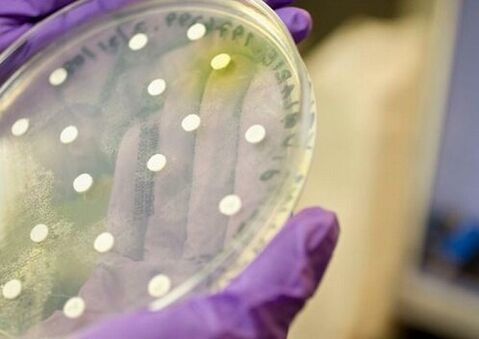 Bacterial culture to diagnose prostatitis